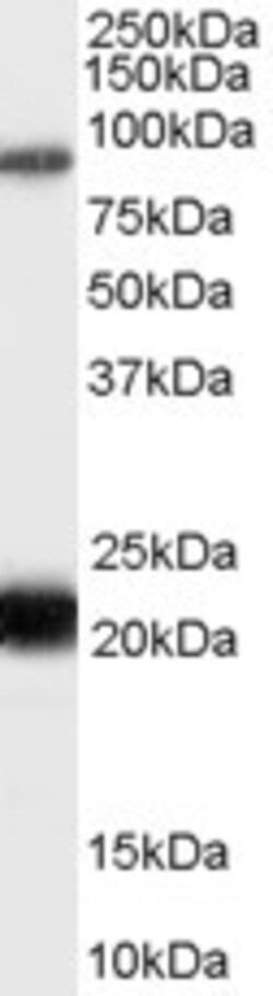 Invitrogen RASAL1 Polyclonal Antibody 100 &mu;g; Unconjugated:Antibodies,