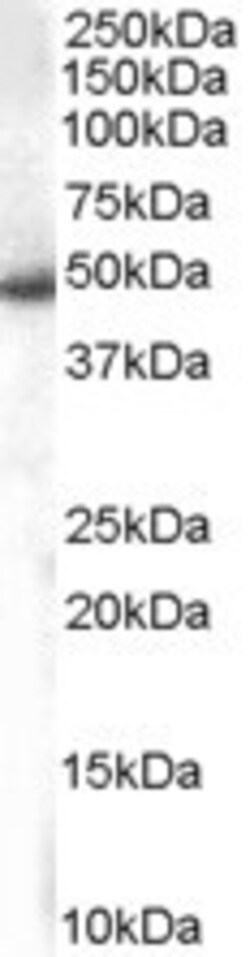 Invitrogen SNX5 Polyclonal Antibody 100 &mu;g; Unconjugated:Antibodies,