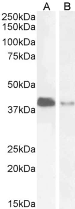 Invitrogen PAR6 Polyclonal Antibody 100 &mu;g; Unconjugated:Antibodies,