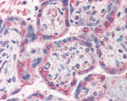 Invitrogen PDLIM1 Polyclonal Antibody 100 &mu;g; Unconjugated:Antibodies,