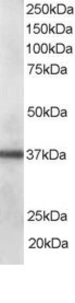 Invitrogen PDLIM1 Polyclonal Antibody 100 &mu;g; Unconjugated:Antibodies,