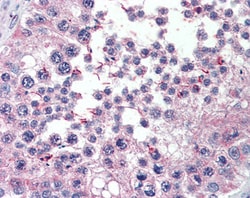 Invitrogen RanBP16 Polyclonal Antibody 100 &mu;g; Unconjugated:Antibodies,