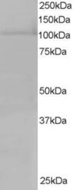 Invitrogen RanBP16 Polyclonal Antibody 100 &mu;g; Unconjugated:Antibodies,