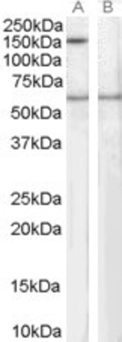 SIPA1 Polyclonal Antibody, Invitrogen 100 &mu;g; Unconjugated:Antibodies,