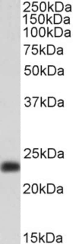 Invitrogen TAGLN Polyclonal Antibody 100 &mu;g; Unconjugated:Antibodies,