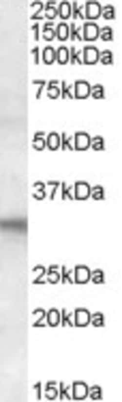 Invitrogen FHL2 Polyclonal Antibody 100 μg; Unconjugated:Antibodies,