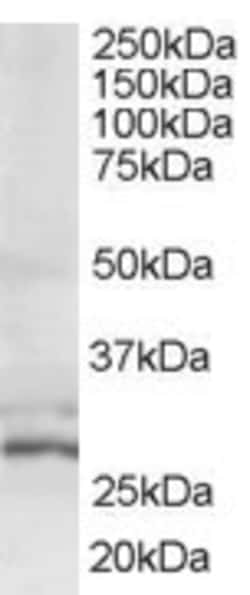 Invitrogen TIP30 Polyclonal Antibody 100 &mu;g; Unconjugated:Antibodies,