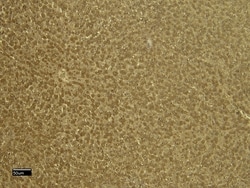 Invitrogen VDAC2 Polyclonal Antibody 100 &mu;g; Unconjugated:Antibodies,