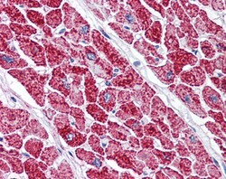 Invitrogen VDAC2 Polyclonal Antibody 100 &mu;g; Unconjugated:Antibodies,