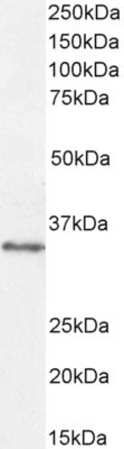 Invitrogen VDAC2 Polyclonal Antibody 100 &mu;g; Unconjugated:Antibodies,