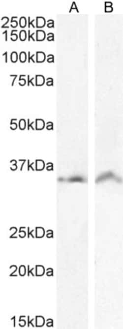 Invitrogen VDAC2 Polyclonal Antibody 100 &mu;g; Unconjugated:Antibodies,