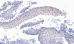 Invitrogen PAX3 Polyclonal Antibody 100 &mu;g; Unconjugated:Antibodies,