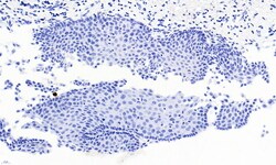 Invitrogen PAX3 Polyclonal Antibody 100 &mu;g; Unconjugated:Antibodies,