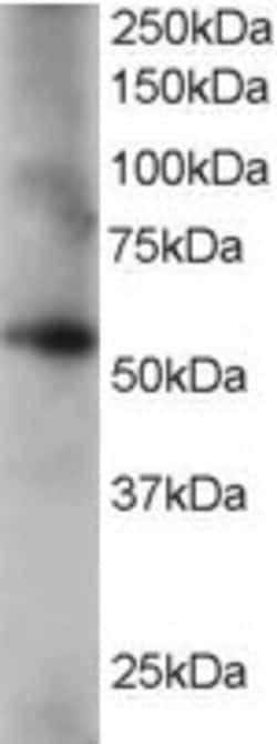 Invitrogen Coronin 3 Polyclonal Antibody 100 &mu;g; Unconjugated:Antibodies,