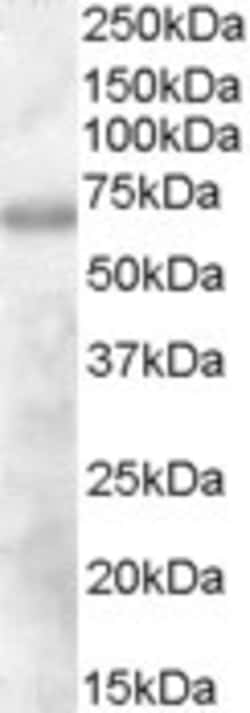 Invitrogen DEF6 Polyclonal Antibody 100 &mu;g; Unconjugated:Antibodies,