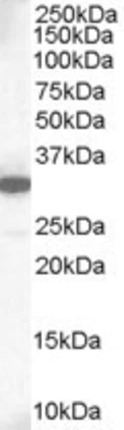 Invitrogen MCL-1 Polyclonal Antibody 100 &mu;g | Buy Online | Invitrogen&trade; | Fisher Scientific