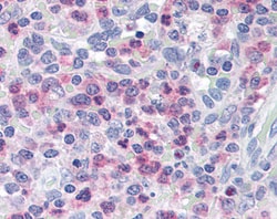 Invitrogen Munc13-4 Polyclonal Antibody 100 &mu;g; Unconjugated:Antibodies,