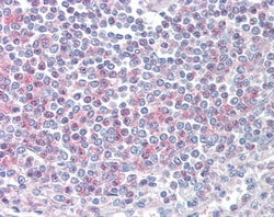 Invitrogen CD2BP2 Polyclonal Antibody 100 &mu;g | Buy Online | Invitrogen&trade; | Fisher Scientific