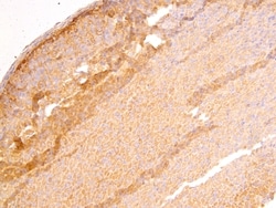 Invitrogen DLC1 Polyclonal Antibody 100 &mu;g; Unconjugated:Antibodies,