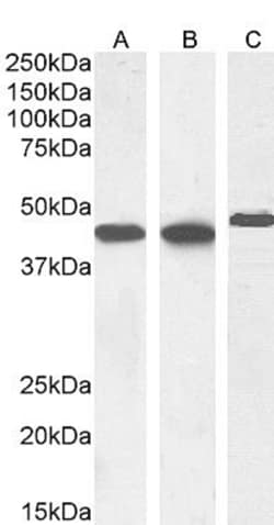 Invitrogen Alpha-Smooth Muscle Actin Polyclonal Antibody 100 &mu;g; Unconjugated:Antibodies,