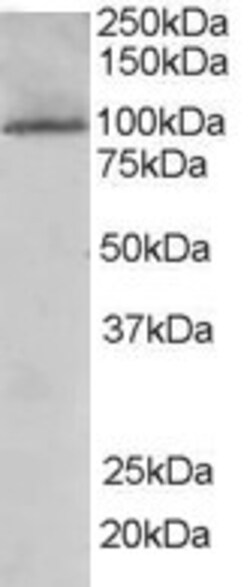 Invitrogen JIK Polyclonal Antibody 100 &mu;g; Unconjugated:Antibodies,