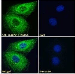 Invitrogen TXNDC5 Polyclonal Antibody 100 &mu;g | Buy Online | Invitrogen&trade; | Fisher Scientific
