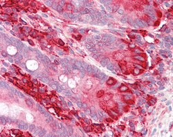 Invitrogen TXNDC5 Polyclonal Antibody 100 &mu;g | Buy Online | Invitrogen&trade; | Fisher Scientific