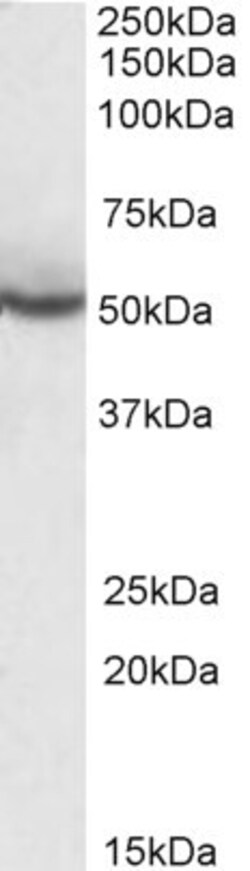 Invitrogen PPAR delta Polyclonal Antibody 100 &mu;g | Buy Online | Invitrogen&trade; | Fisher Scientific