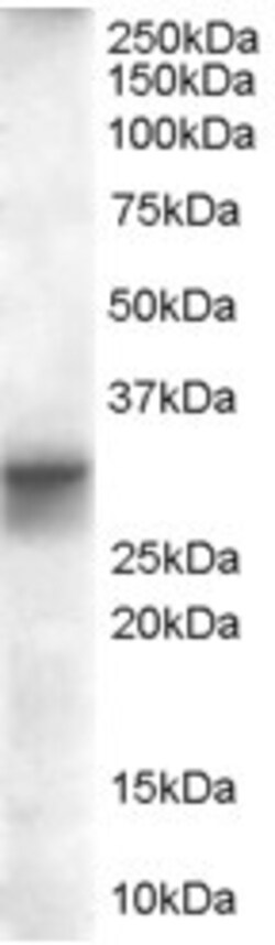 Invitrogen FHL1 Isoform B Polyclonal Antibody 100 &mu;g; Unconjugated:Antibodies,
