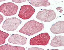 Invitrogen TOM1L2 Polyclonal Antibody 100 &mu;g; Unconjugated:Antibodies,