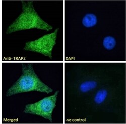 Invitrogen PSMD2 Polyclonal Antibody 100 &mu;g; Unconjugated:Antibodies,