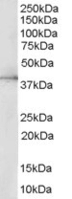 Invitrogen ERK2 Polyclonal Antibody 100 &mu;g | Buy Online | Invitrogen&trade; | Fisher Scientific