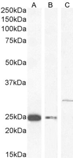 Invitrogen COMT Polyclonal Antibody 100 &mu;g | Buy Online | Invitrogen&trade; | Fisher Scientific