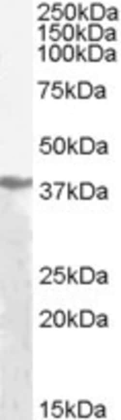 Invitrogen Alcohol dehydrogenase Pan Polyclonal Antibody 100 &mu;g; Unconjugated:Antibodies,