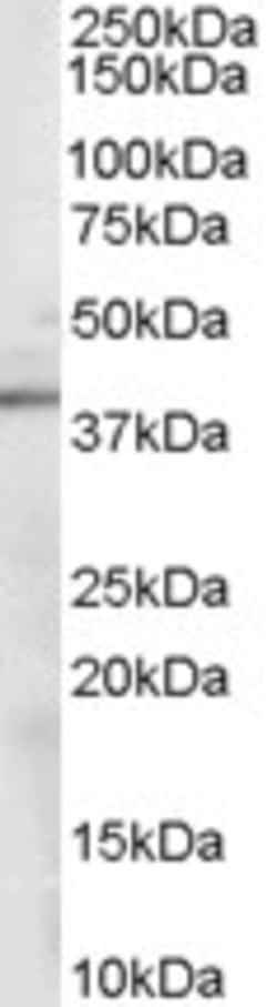 Invitrogen Sorbitol Dehydrogenase Polyclonal Antibody 100 &mu;g; Unconjugated:Antibodies,