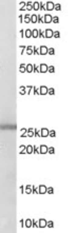 Invitrogen GSTM1/GSTM2 Polyclonal Antibody 100 &mu;g; Unconjugated:Antistoffer