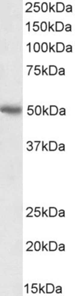 Invitrogen PD-L1 Polyclonal Antibody 100 &mu;g; Unconjugated:Anticuerpos