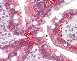 Invitrogen AKR1C3 Polyclonal Antibody 100 μg; Unconjugated:Antibodies,