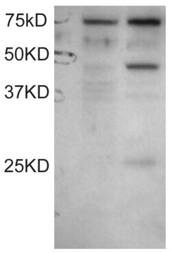 Invitrogen DYX1C1 Polyclonal Antibody 100 &mu;g; Unconjugated:Antibodies,