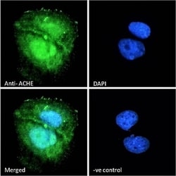 Invitrogen Acetylcholinesterase Polyclonal Antibody 100 &mu;g; Unconjugated:Antibodies,