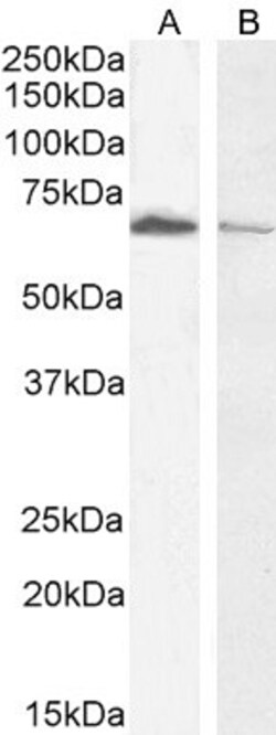 Invitrogen Acetylcholinesterase Polyclonal Antibody 100 &mu;g; Unconjugated:Antibodies,