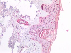 Invitrogen NPM1 Polyclonal Antibody 100 &mu;g; Unconjugated:Antibodies,