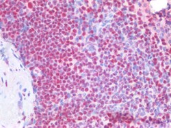 Invitrogen NPM1 Polyclonal Antibody 100 &mu;g; Unconjugated:Antibodies,