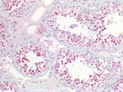 Invitrogen NPM1 Polyclonal Antibody 100 &mu;g; Unconjugated:Antibodies,