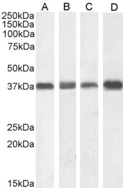Invitrogen NPM1 Polyclonal Antibody 100 &mu;g; Unconjugated:Antibodies,
