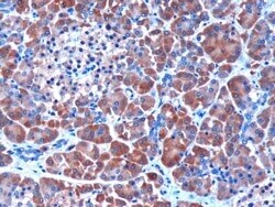 Invitrogen SERPINI2 Polyclonal Antibody 100 μg; Unconjugated:Antibodies,