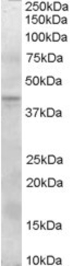 Invitrogen SERPINI2 Polyclonal Antibody 100 μg; Unconjugated:Antibodies,