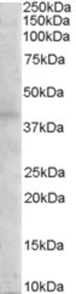 Invitrogen MC3R Polyclonal Antibody 100 &mu;g | Buy Online | Invitrogen&trade; | Fisher Scientific