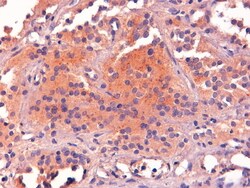 POMC Polyclonal Antibody, Invitrogen 100 &mu;g; Unconjugated:Antibodies,