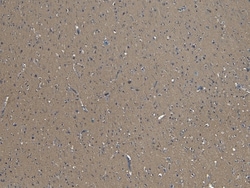 Invitrogen GAD65 Polyclonal Antibody 100 &mu;g; Unconjugated:Antibodies,